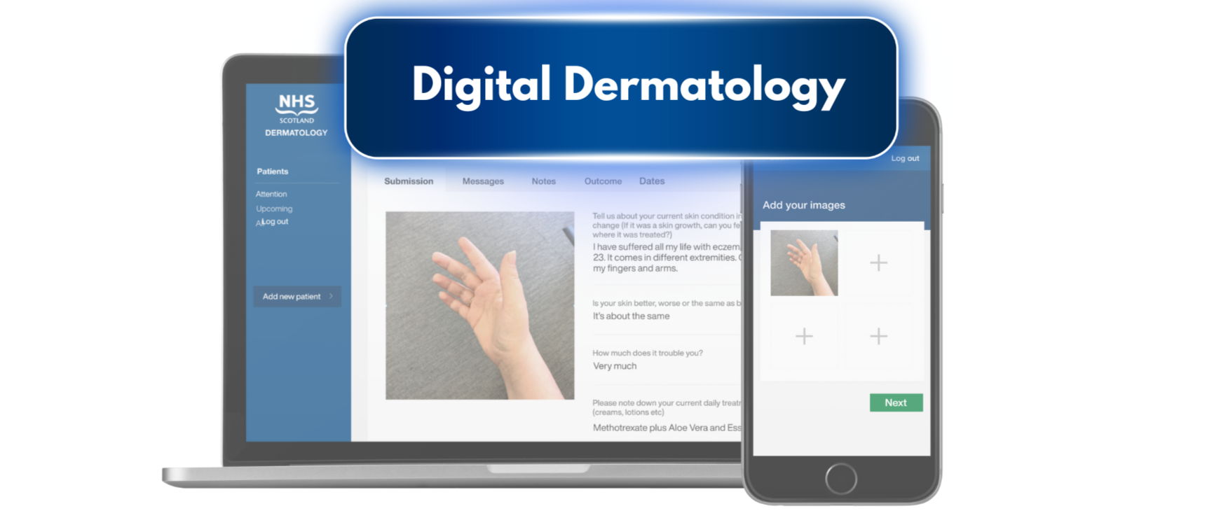 Laptop and Phone with derm app